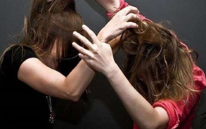 ​Kürdəmirdə iki elti arasında dava, azyaşlı xəsarət aldı