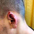 В Сумгайыте ссора между мужчинами закончилась откушенным ухом