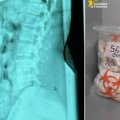 В Италии задержали женщину с 1,4 кг героина в желудке