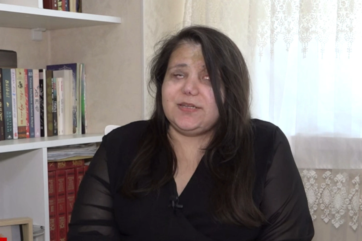 Gəncə terrorunda gözlərini itirən qadın başına gələnləri danışdı: 
