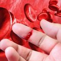 “Hemofiliya: irsi xəstəlik yoxsa idarə oluna bilən vəziyyət?” - Ekspert açıqladı