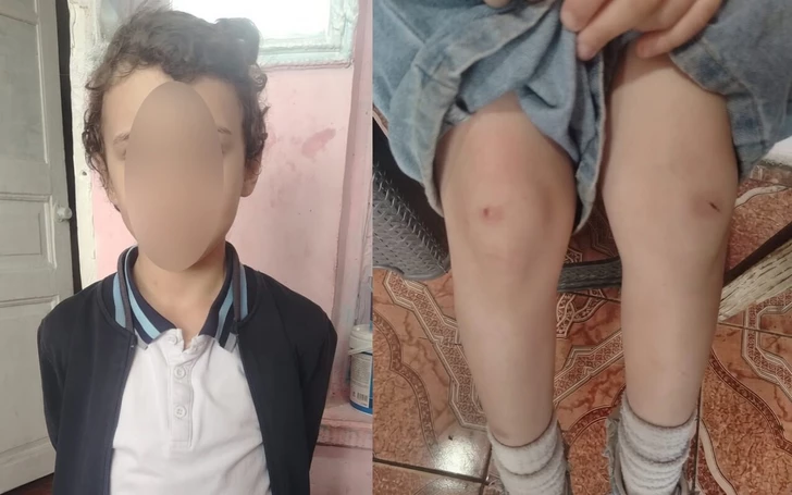 В школе Гянджи четвероклассница избила ученика второго класса-ФОТО