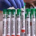 Власти Израиля приняли меры по сдерживанию хантавируса