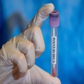 Hantavirus aşkarlanan gəmidən təxliyə edilən Türkiyə vətəndaşlarının test nəticələri neqativ çıxıb