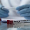 ÜST-dən Ebola ilə bağlı XƏBƏRDARLIQ: Yoluxanların sayı kəskin artır