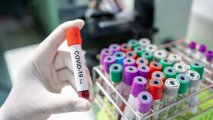 В Армении выявлено 113 новых случаев заражения коронавирусом
