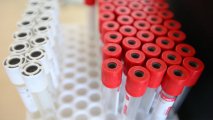 В Саудовской Аравии выявили более 1,9 тысячи новых случаев коронавируса