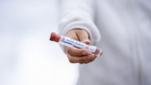 Azərbaycanda koronavirusa daha 840 nəfər yoluxub, 9 nəfər ölüb
