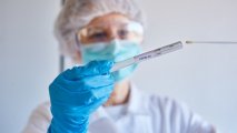 Azərbaycanda daha 1697 nəfər koronavirusa yoluxub, 13 nəfər ölüb