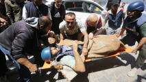 İsrail ordusunun hədəf aldığı türk jurnalist ayağını itirdi...-