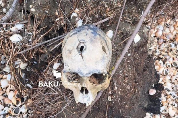 В Нефтчале найден человеческий череп с пулевым отверстием-ФОТО