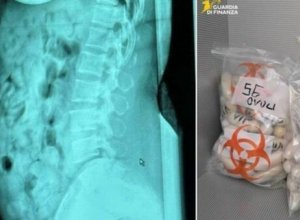 В Италии задержали женщину с 1,4 кг героина в желудке