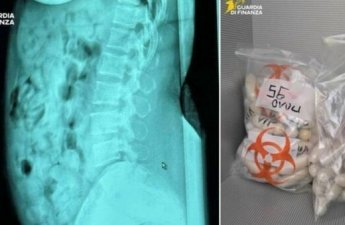 В Италии задержали женщину с 1,4 кг героина в желудке