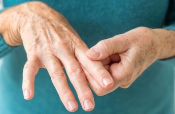 Oynaq ağrılarınızın səbəbi artrit ola bilərmi?