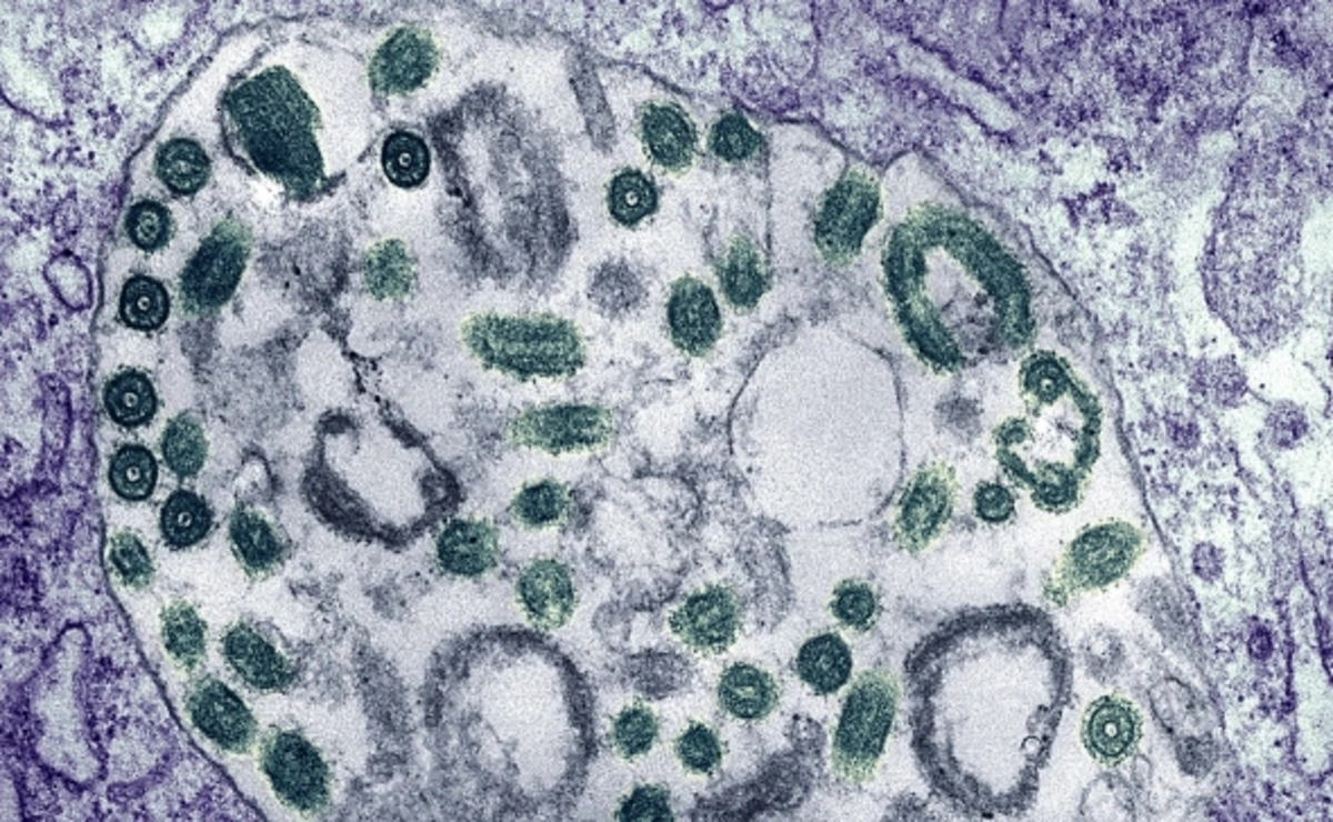 Efiopiyada təhlükəli virusun yayıldığı TƏSDİQLƏNDİ