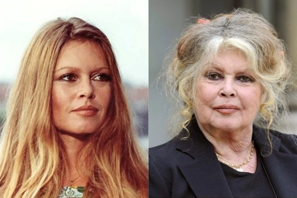 Bricit Bardo xəstəxanaya yerləşdirilib