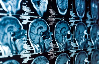 Beynin inkişafına bu gen nəzarət edirmiş...