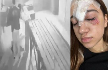 Bakıda qorxu evinə gedən 15 yaşlı qız xəsarət aldı - Alnına 11 tikiş qoyuldu