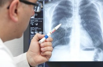 Bakıda yayılan xəstəlik təhlükəli H3N2 virusudur? - həkimdən xəbərdarlıq