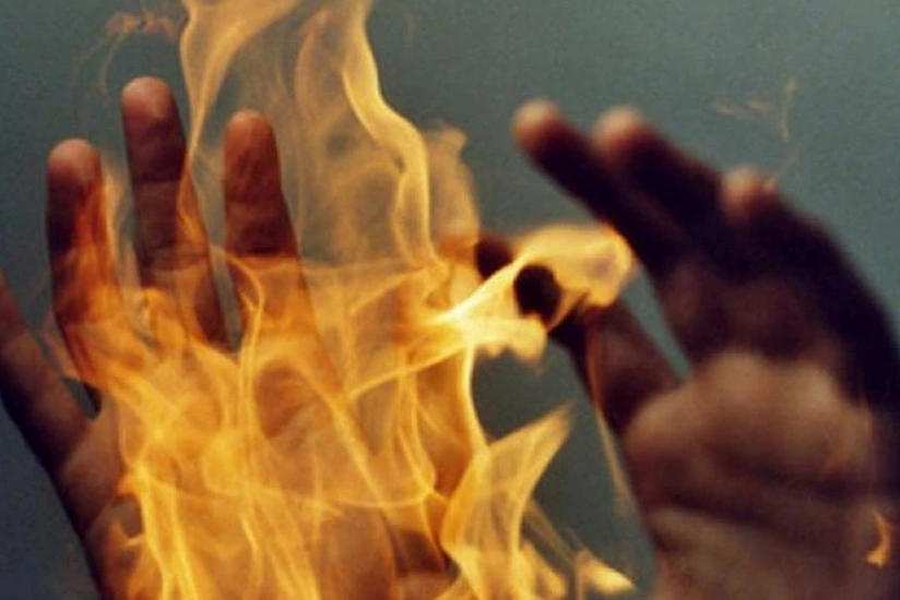 Naxçıvanda 66 yaşlı kişi ocaqda yanaraq öldü