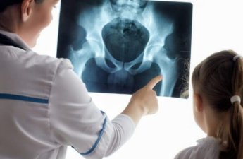 Həkimdən XƏBƏRDARLIQ: “Uşaqlar lazımsız yerə rentgen ediləndə…”