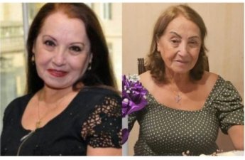 “Rejissor dedi ki, belə qız ola bilməz, gözləri oynayır”-FOTOLAR