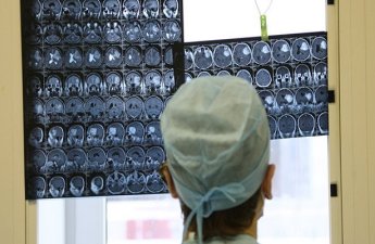 Kişi beyni qadın beynindən daha tez qocalır – ARAŞDIRMA