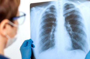 Məktəblilər arasında pnevmoniya sürətlə yayılır - XƏBƏRDARLIQ