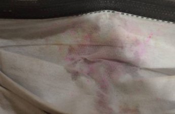 Bakıda xəstəlik yayan tibbi maskalar satılır? İDDİA