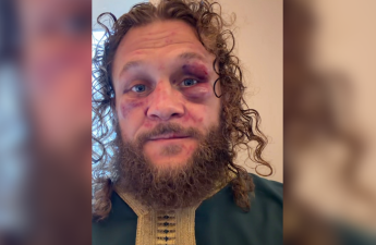 Rafael Fiziyevdən məğlubiyyət şərhi: “Yaxşıca döyüldüm, amma geri qayıdacağam”