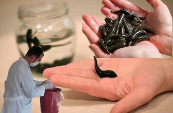 “Göldən tutulan zəlilər bədənə infeksiya yayır, qana keçəndə isə insan ölə bilər” - Alimdən SENSASİYALI AÇIQLAMA+ÖZƏL