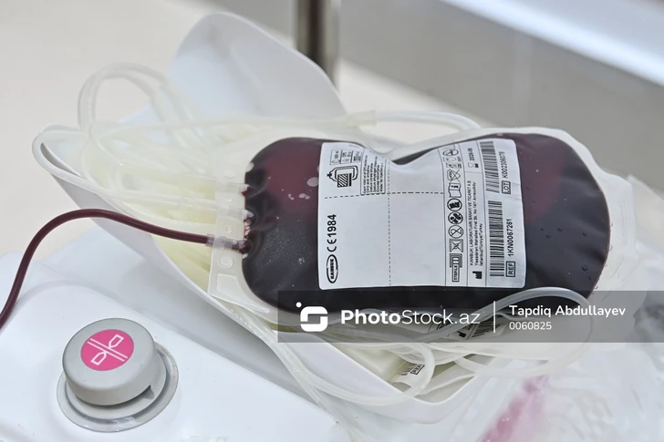 В Азербайджане названы самые дефицитные группы крови