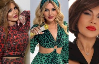 Öz saçı olmadığını etiraf etdi