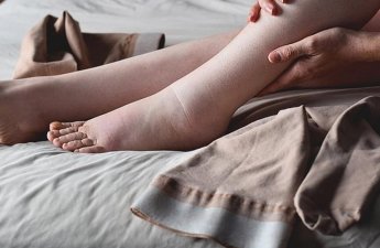 Ayaq şişkinliyinin təhlükəli əlamətləri açıqlandı