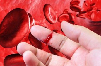 “Hemofiliya: irsi xəstəlik yoxsa idarə oluna bilən vəziyyət?” - Ekspert açıqladı