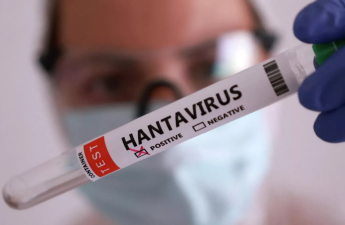 Təşvişə qapılmadan sadə gigiyena qaydalarına əməl etmək lazımdır - Həkim hantavirusla bağlı iddialara aydınlıq gətirdi