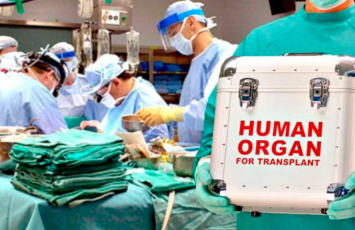 Azərbaycanda orqan transplantasiyasında  ciddi artım - Bəs din nə deyir?