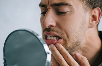 Hansı qidalar dişləri daha çox ləkələyir? - Stomatoloq AÇIQLADI