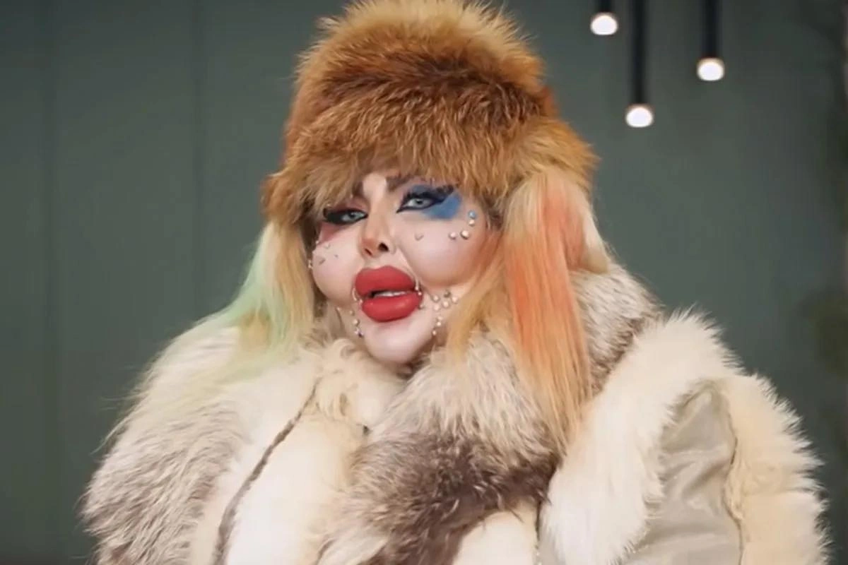 İranlı bloqer estetik əməliyyatların sayına görə rekord vurub