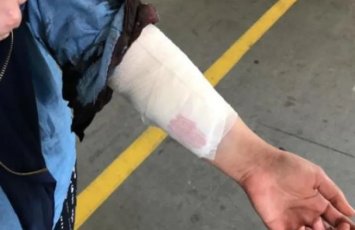 Salyanda kişi qısqanc sevgilisini döyüb dişlədi