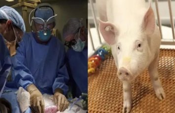 60 gündən çoxdur donuz böyrəyi ilə yaşayır