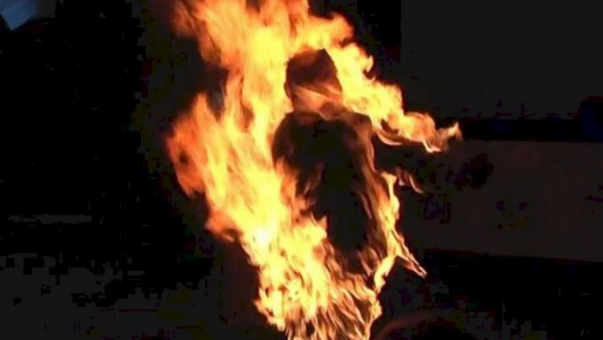 Paytaxtda yanıq xəsarətləri alan kişi səkkiz gün sonra öldü