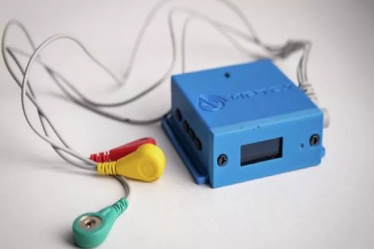 İnfarktın yaxınlaşmasından XƏBƏRDARLIQ edən cihaz hazırlandı