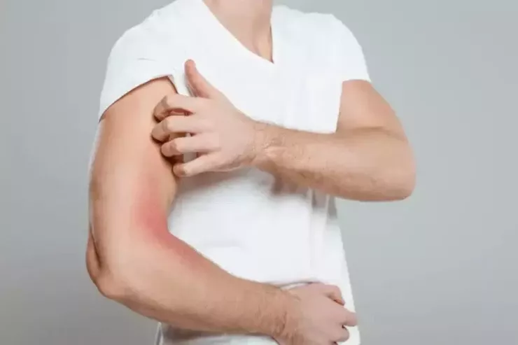 Bədəninizdəki qaşınma: Bunun 4 fərqli xərçəng növü əlaməti ola biləcəyi XƏBƏRDARLIĞI