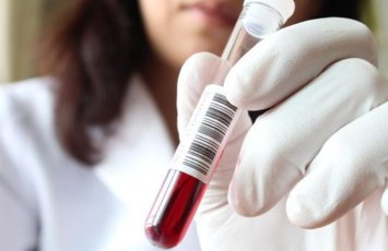 Evlənmək istəyən 700-dən çox şəxsdə talassemiya daşıyıcılığı aşkarlandı