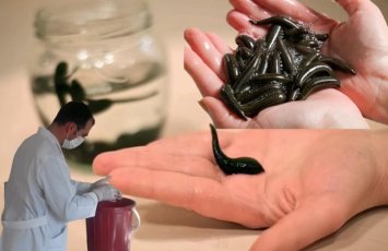 “Azərbaycanda zəli tükənir, ovlanmasına qadağa qoyulsun, bizdə 2 manat, xaricdə 20 avrodur” - FOTO+ÖZƏL