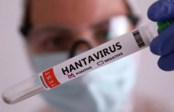 Təşvişə qapılmadan sadə gigiyena qaydalarına əməl etmək lazımdır - Həkim hantavirusla bağlı iddialara aydınlıq gətirdi
