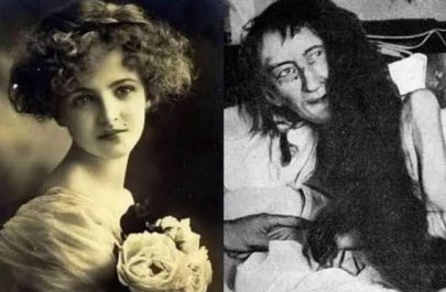 Anasının 25 il otaqda zəncirlədiyi qadının dəhşətli heyakəsi