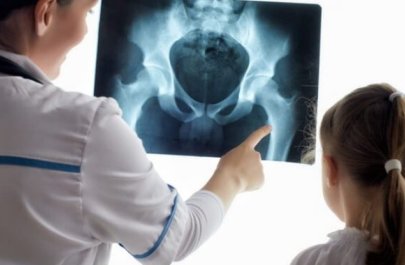 Həkimdən XƏBƏRDARLIQ: “Uşaqlar lazımsız yerə rentgen ediləndə…”