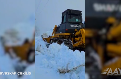 Güclü qarın yaratdığı fəsadlar aradan qaldırılıb - VİDEO